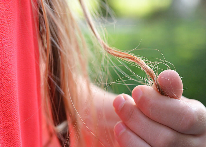 hair loss